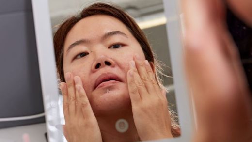 How to select the best moisturizer for oily skin